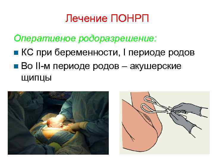 Лечение ПОНРП Оперативное родоразрешение: КС при беременности, I периоде родов Во II-м периоде родов