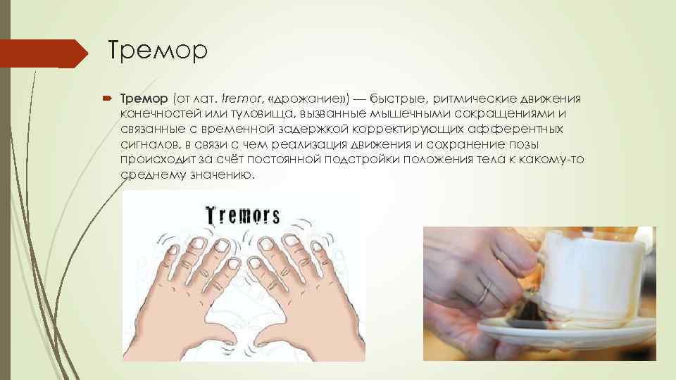 Тремор (от лат. tremor, «дрожание» ) — быстрые, ритмические движения конечностей или туловища, вызванные