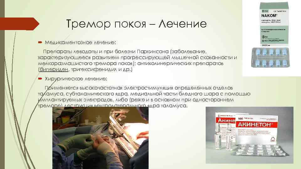 Тремор покоя – Лечение Медикаментозное лечение: Препараты леводопы и при болезни Паркинсона (заболевание, характеризующееся