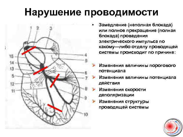 Карта смп аритмия