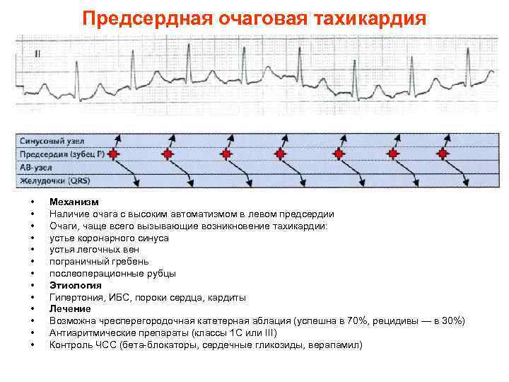 Предсердная тахикардия. Эктопическая предсердная тахикардия ЭКГ. Фокусная предсердная тахикардия ЭКГ. Фокусная эктопическая предсердная тахикардия ЭКГ. Полифокусная предсердная тахикардия на ЭКГ.