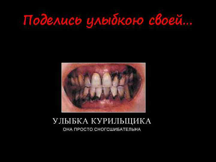 Поделись улыбкою своей… 