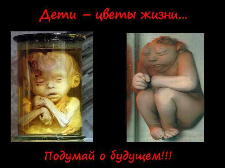 Дети – цветы жизни… Подумай о будущем!!! 