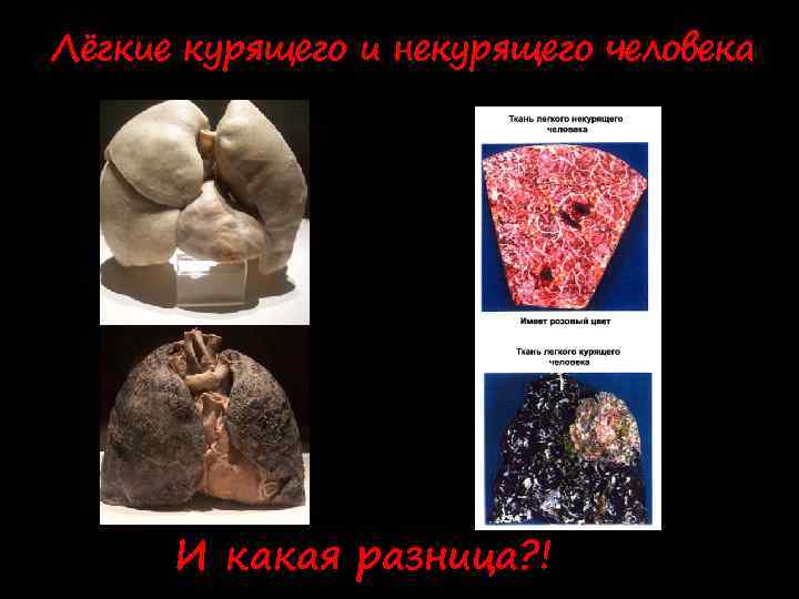 Лёгкие курящего и некурящего человека И какая разница? ! 