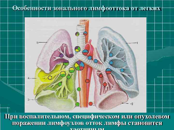 Особенности зонального лимфооттока от легких При воспалительном, специфическом или опухолевом поражении лимфоузлов отток лимфы