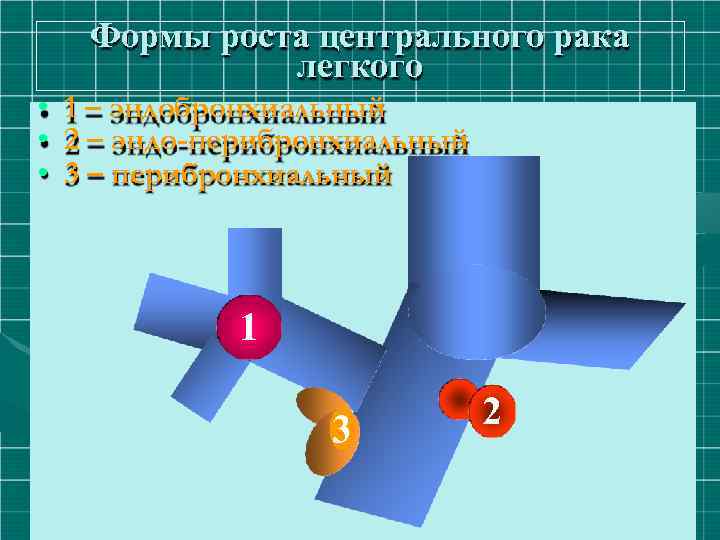 Формы роста центрального рака легкого • 1 – эндобронхиальный • 2 – эндо-перибронхиальный •