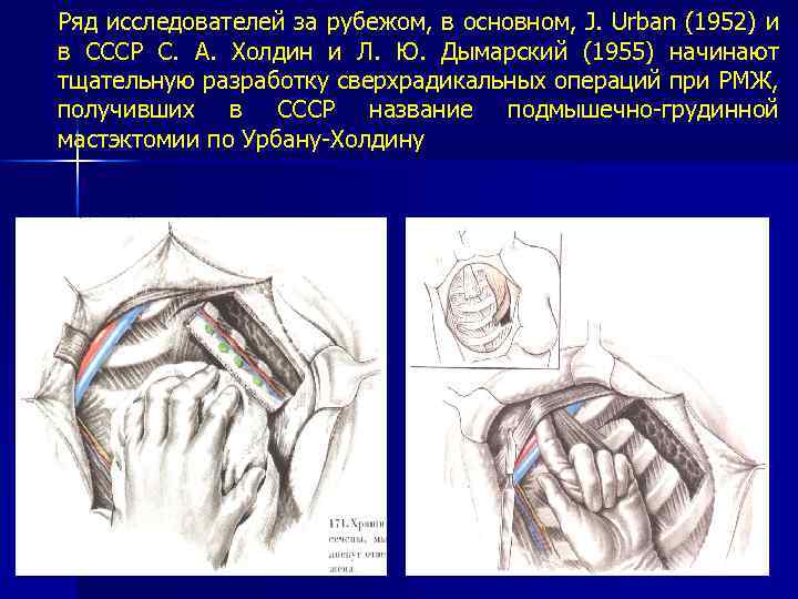 Ряд исследователей за рубежом, в основном, J. Urban (1952) и в СССР С. А.