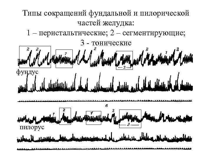 Типы сокращений фундальной и пилорической частей желудка: 1 – перистальтические; 2 – сегментирующие; 3