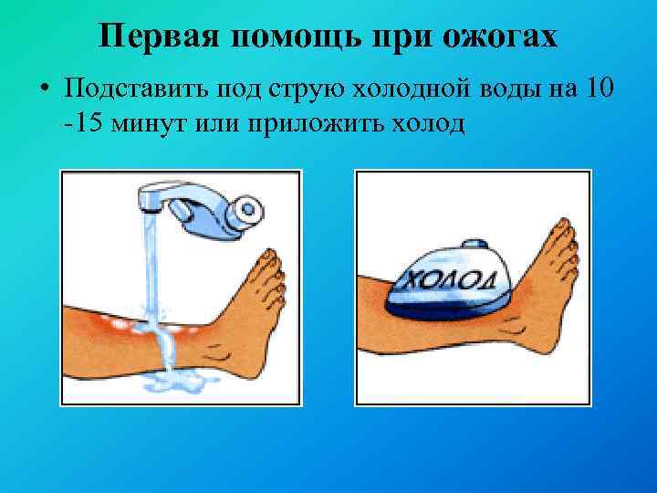 Первая помощь при ожогах • Подставить под струю холодной воды на 10 -15 минут