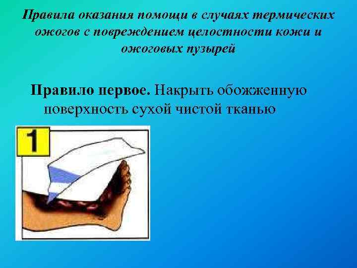 Правила оказания помощи в случаях термических ожогов с повреждением целостности кожи и ожоговых пузырей