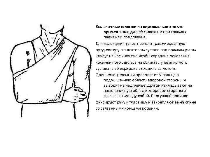 Косыночные повязки на верхнюю конечность применяются для еѐ фиксации при травмах плеча или предплечья.