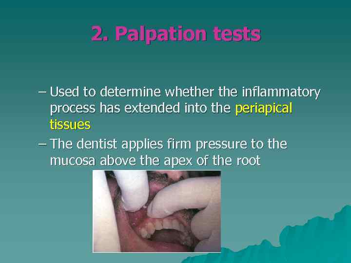 2. Palpation tests – Used to determine whether the inflammatory process has extended into