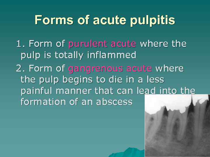 Forms of acute pulpitis 1. Form of purulent acute where the pulp is totally