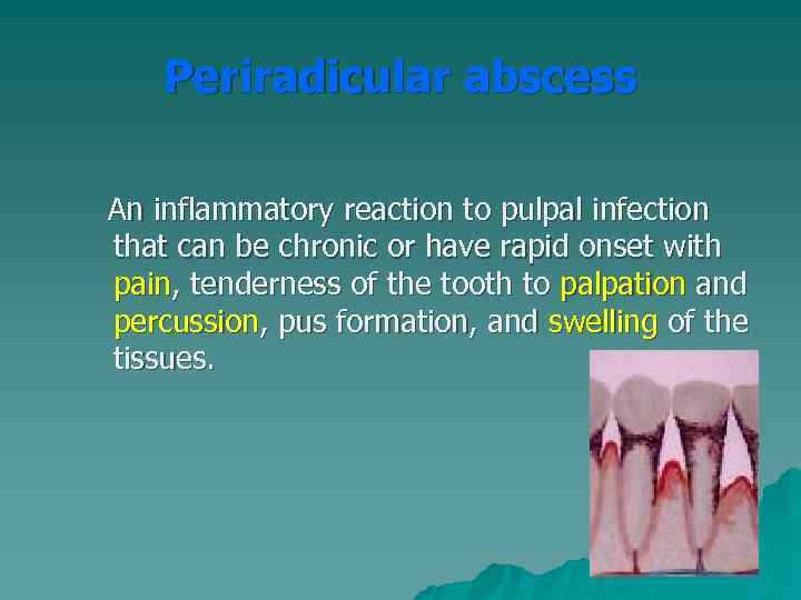 Periradicular abscess An inflammatory reaction to pulpal infection that can be chronic or have