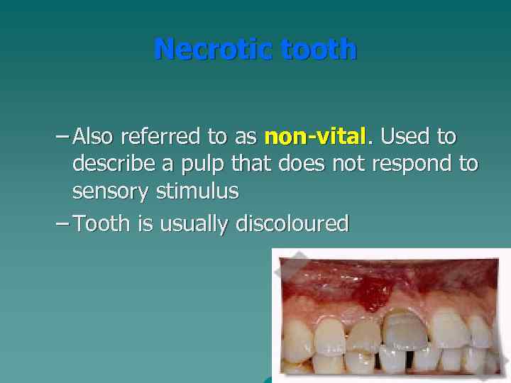 Necrotic tooth – Also referred to as non-vital. Used to describe a pulp that
