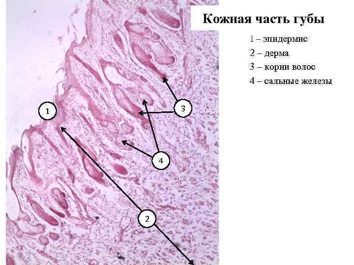 Срез кожи с волосом гистология рисунок