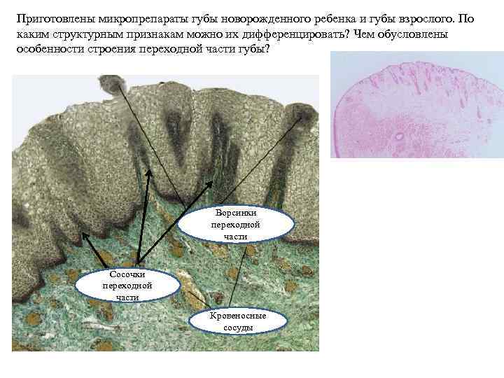 Приготовлены микропрепараты губы новорожденного ребенка и губы взрослого. По каким структурным признакам можно их
