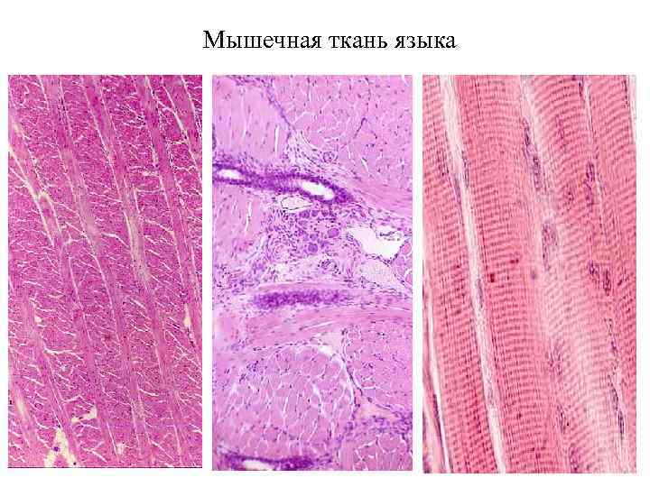 Мышечная ткань языка 