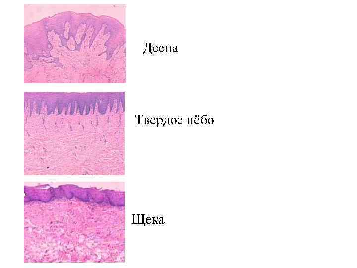 Типы слизистой. Препарат твердого неба гистологический. Твердое небо гистология препарат. Десны твердое небо гистология. Десна гистология препарат.