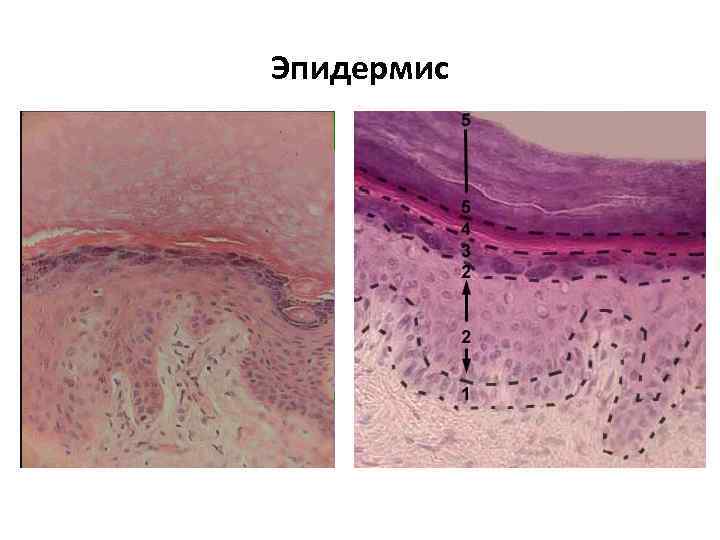 Эпидермис 