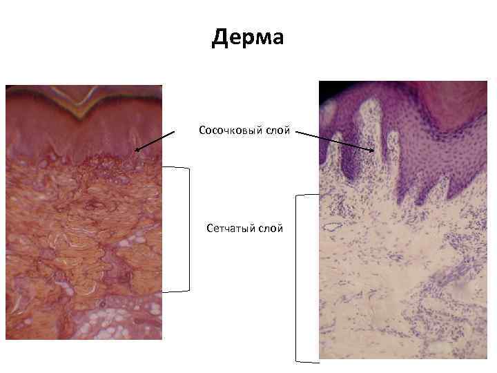Дерма Сосочковый слой Сетчатый слой 