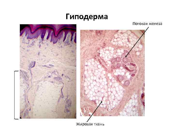 Гиподерма Жировая ткань Потовая железа 