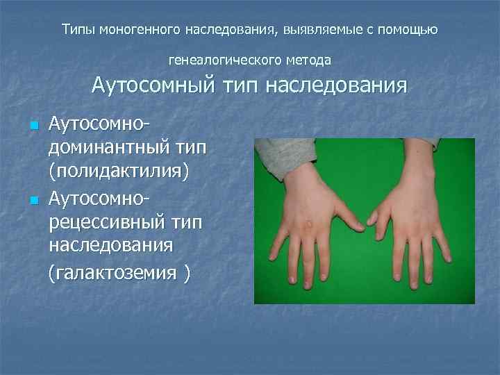 Типы моногенного наследования, выявляемые с помощью генеалогического метода Аутосомный тип наследования n n Аутосомнодоминантный