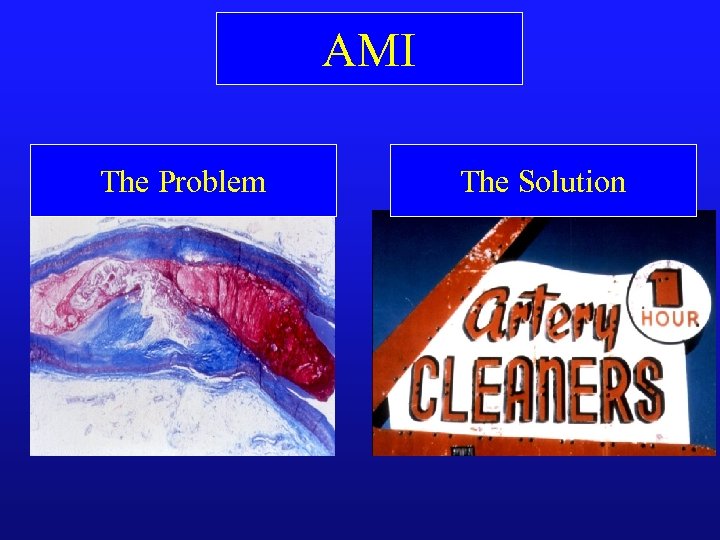 AMI The Problem The Solution 