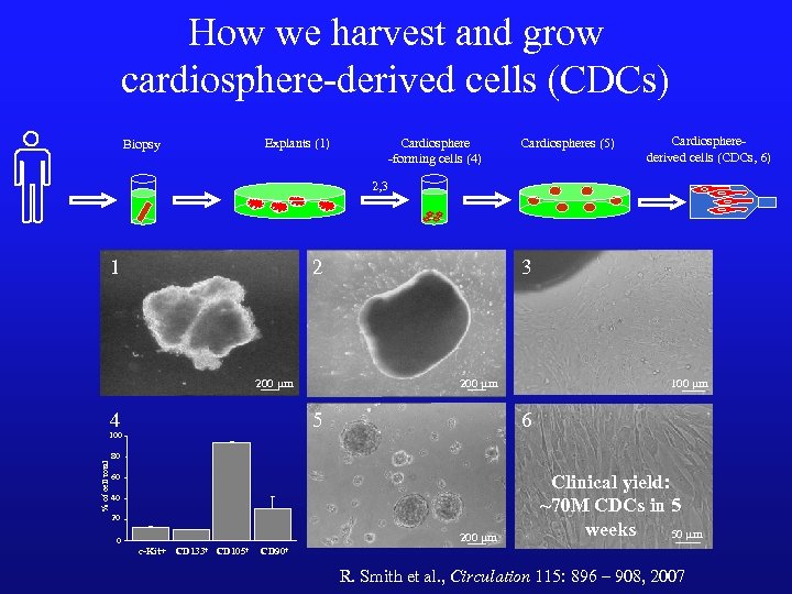 How we harvest and grow cardiosphere-derived cells (CDCs) Explants (1) Biopsy Cardiosphere -forming cells