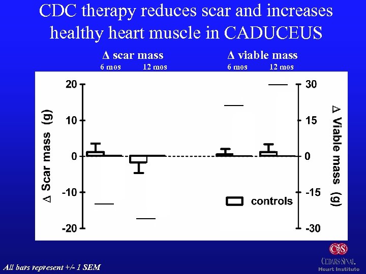 CDC therapy reduces scar and increases healthy heart muscle in CADUCEUS Δ scar mass