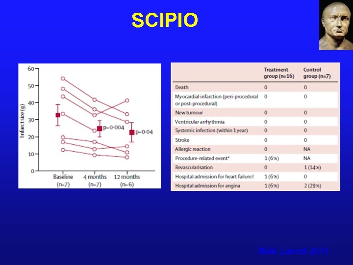 SCIPIO Bolli, Lancet 2011 