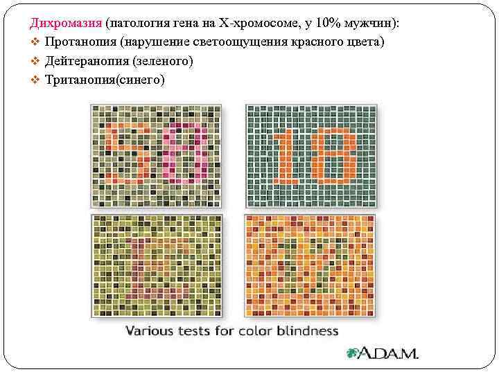 Дихромазия (патология гена на Х-хромосоме, у 10% мужчин): v Протанопия (нарушение светоощущения красного цвета)