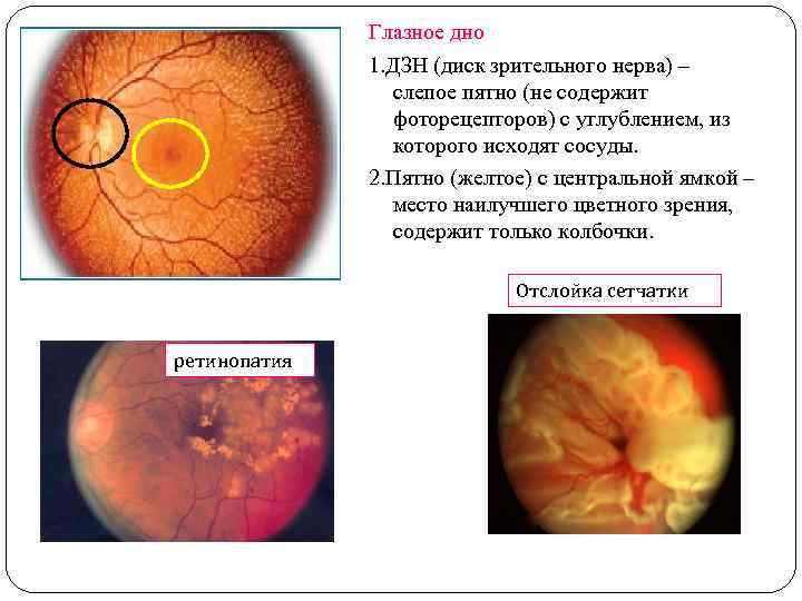 Глазное дно 1. ДЗН (диск зрительного нерва) – слепое пятно (не содержит фоторецепторов) с