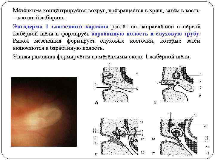 Мезенхима концентрируется вокруг, превращается в хрящ, затем в кость – костный лабиринт. Энтодерма 1