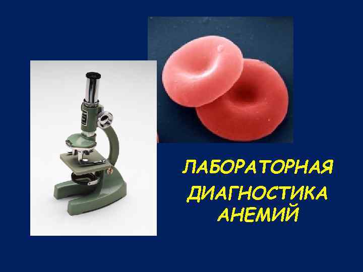 ЛАБОРАТОРНАЯ ДИАГНОСТИКА АНЕМИЙ 