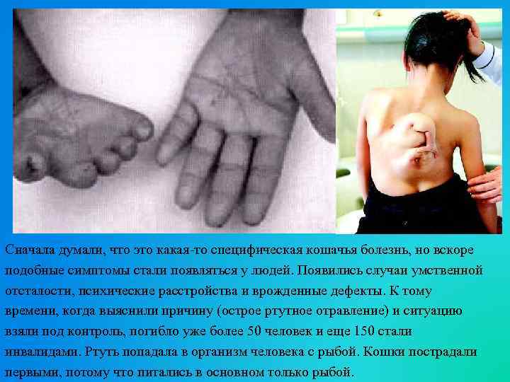 Сначала думали, что это какая-то специфическая кошачья болезнь, но вскоре подобные симптомы стали появляться