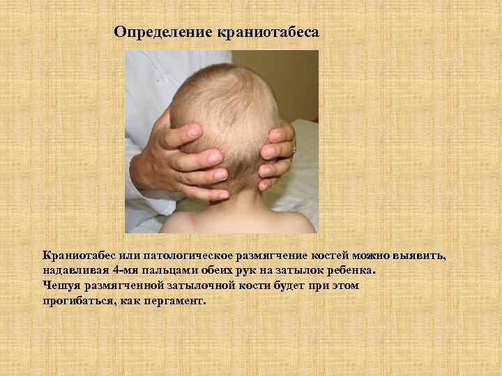 Определение краниотабеса Краниотабес или патологическое размягчение костей можно выявить, надавливая 4 -мя пальцами обеих
