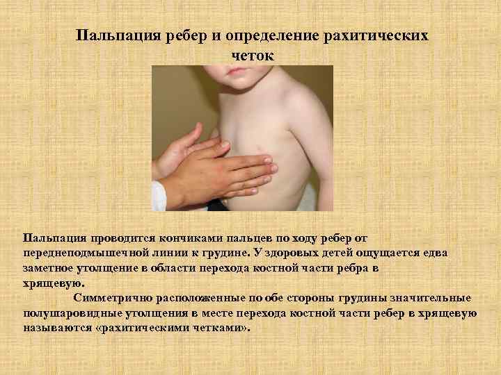 Пальпация молочной железы презентация