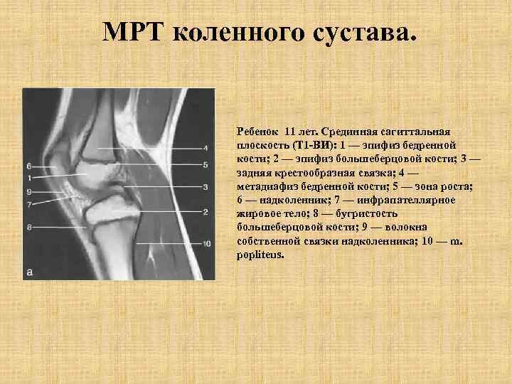 Сесамовидные кости коленного сустава схема