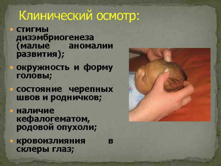 Клинический осмотр: стигмы дизэмбриогенеза (малые аномалии развития); окружность и форму головы; состояние черепных швов