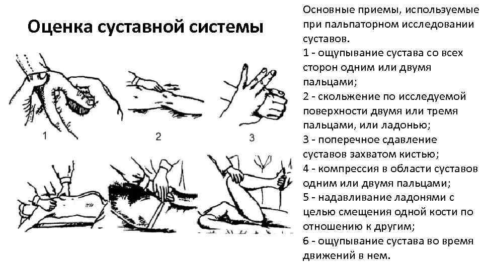 Оценка суставной системы Основные приемы, используемые при пальпаторном исследовании суставов. 1 ощупывание сустава со