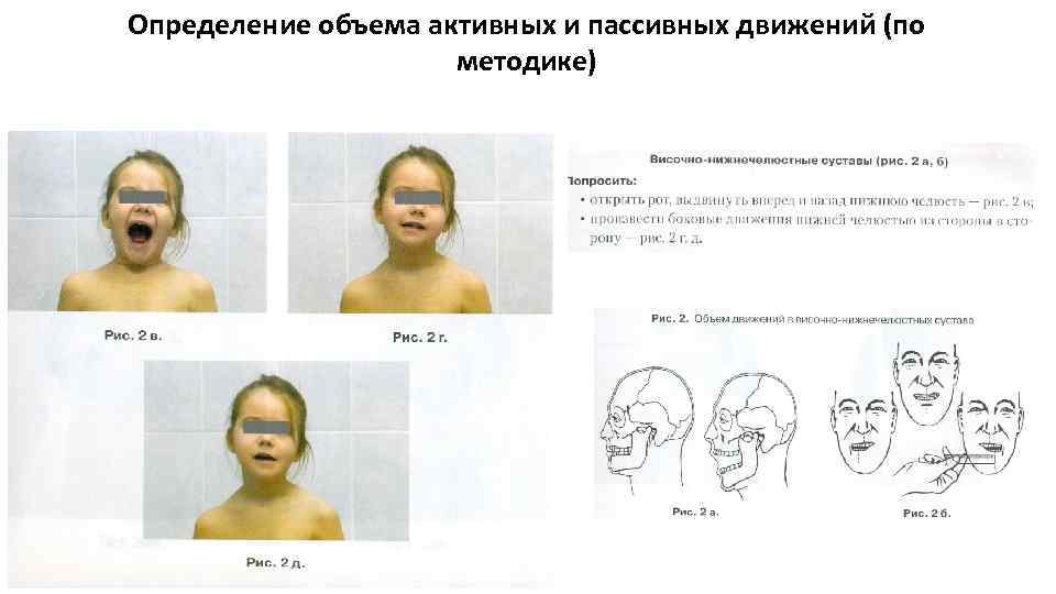 Определение объема активных и пассивных движений (по методике) 