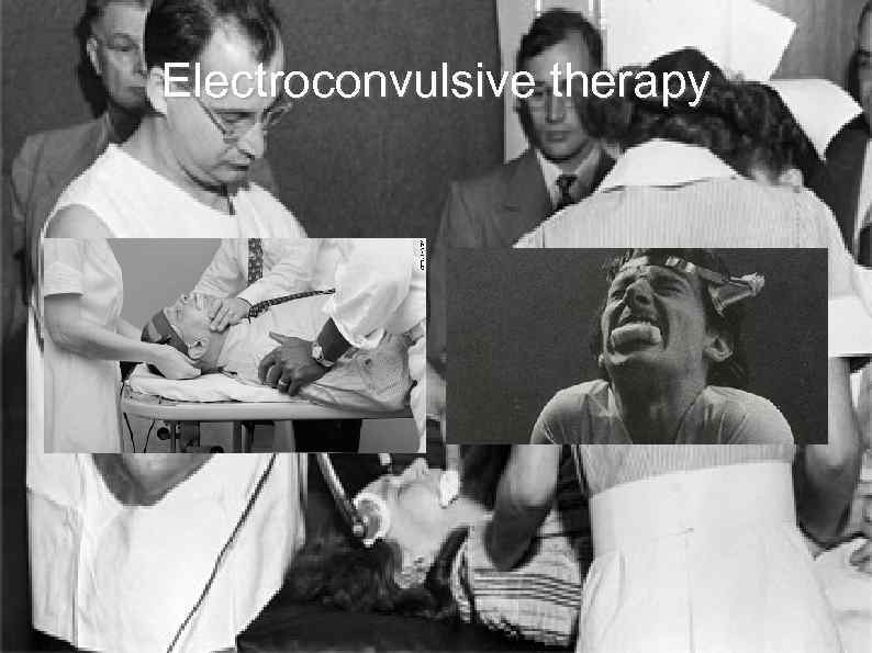 Electroconvulsive therapy 