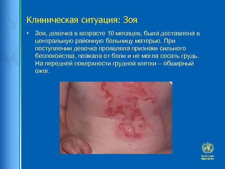 Клиническая ситуация: Зоя • Зоя, девочка в возрасте 10 месяцев, была доставлена в центральную