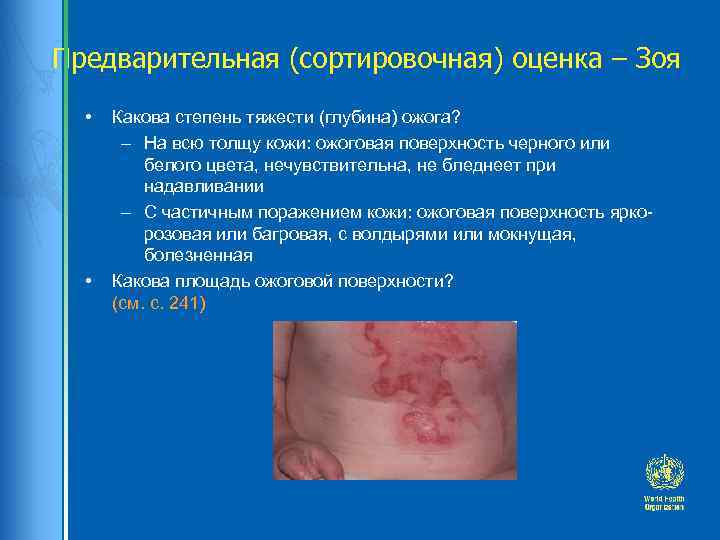 Предварительная (сортировочная) оценка – Зоя • • Какова степень тяжести (глубина) ожога? – На