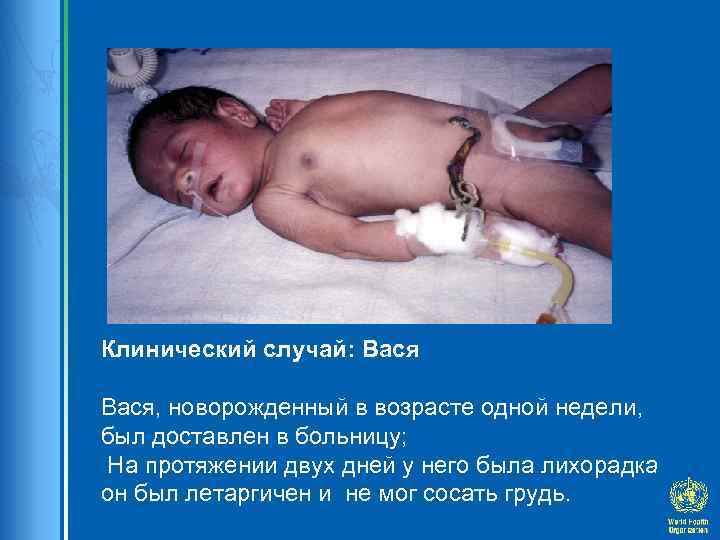 Клинический случай: Вася, новорожденный в возрасте одной недели, был доставлен в больницу; На протяжении