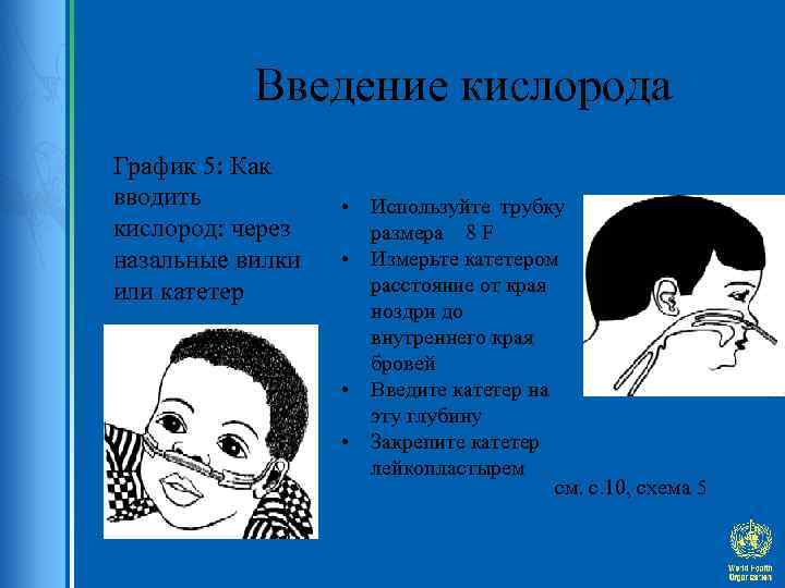 Введение кислорода График 5: Как вводить кислород: через назальные вилки или катетер • Используйте