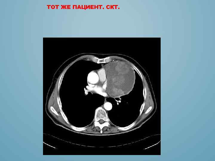 ТОТ ЖЕ ПАЦИЕНТ. СКТ. 