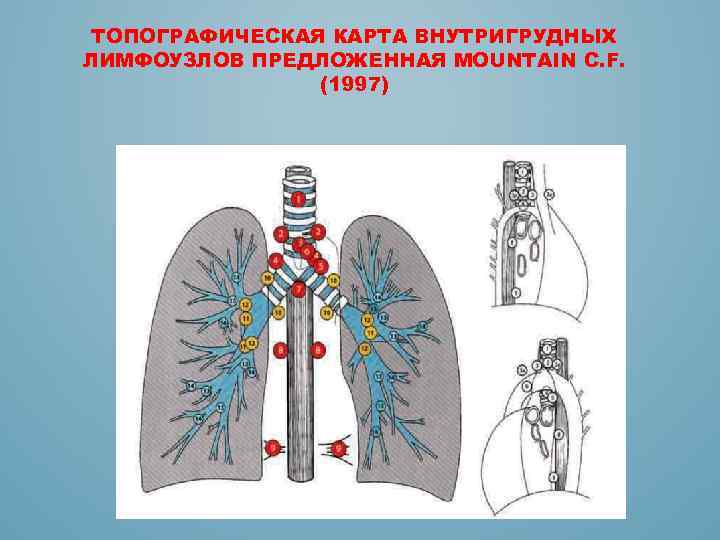 ТОПОГРАФИЧЕСКАЯ КАРТА ВНУТРИГРУДНЫХ ЛИМФОУЗЛОВ ПРЕДЛОЖЕННАЯ MOUNTAIN С. F. (1997) 