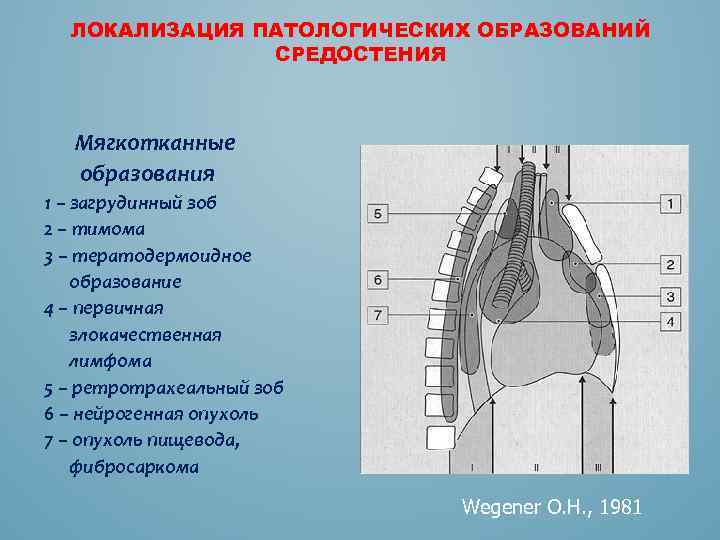 Кисты средостения презентация